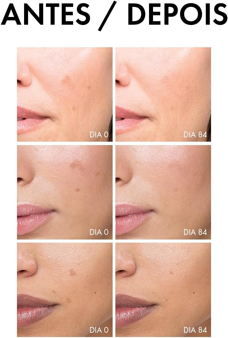 Vichy Liftactiv Pigment Specialist, Sérum Antimanchas, Clareador Facial 30ml - Image 8