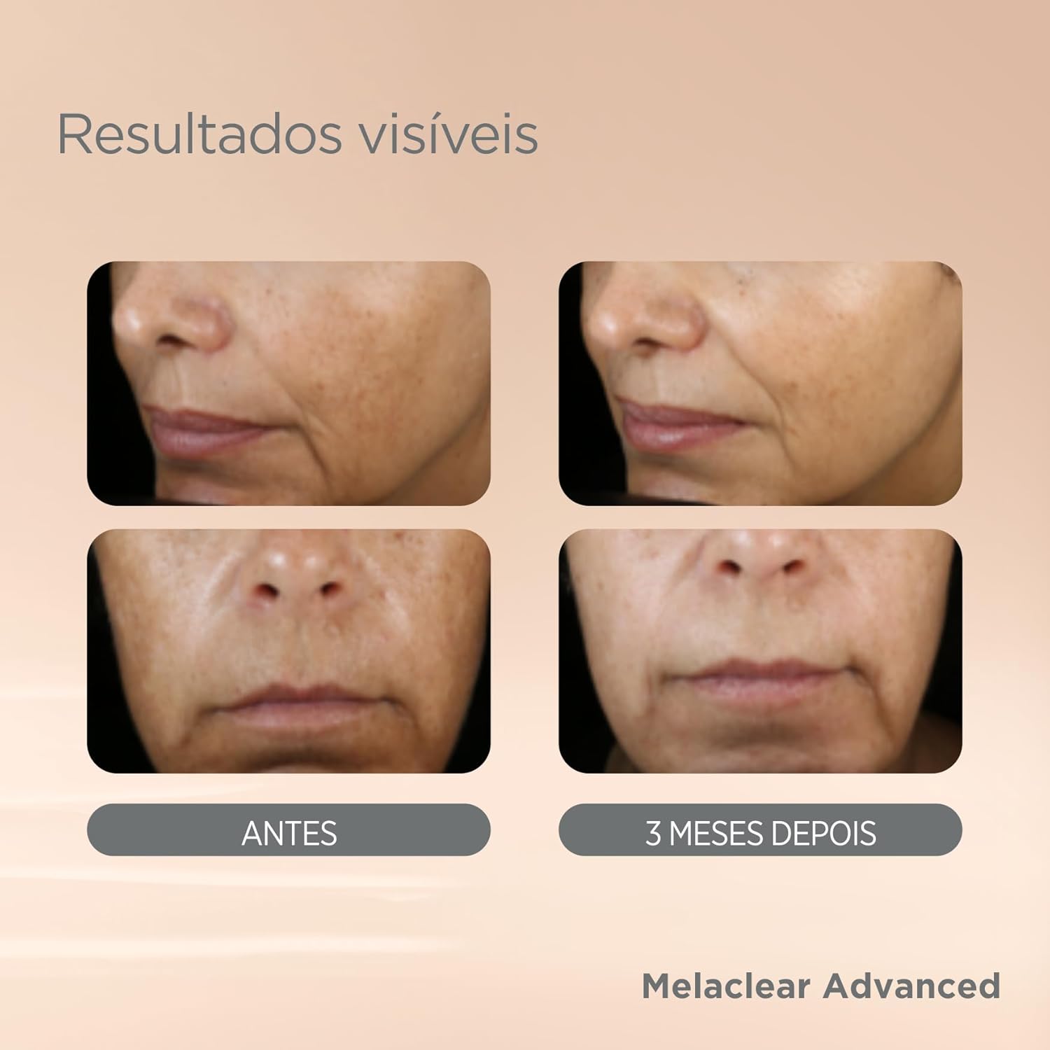 ISDIN Sérum Facial Clareador Anti-Idade Isdinceutics Melaclear Advanced - 30 ml - Image 3