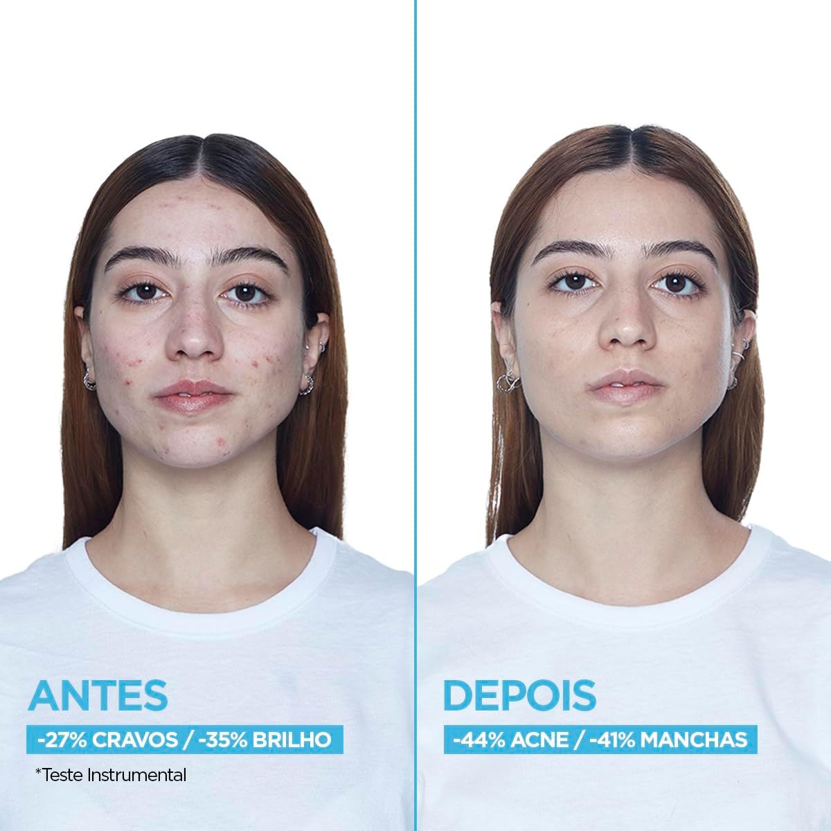 Garnier Sérum Facial Antiacne 15ml - Image 5